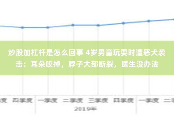 炒股加杠杆是怎么回事 4岁男童玩耍时遭恶犬袭击：耳朵咬掉，脖子大部断裂，医生没办法